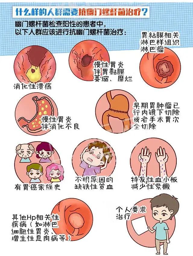 锌硒宝片减肥吗