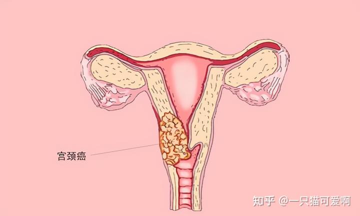 补硒能让淋巴肿大吗